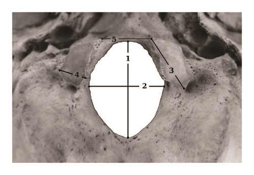 Details are in the caption following the image