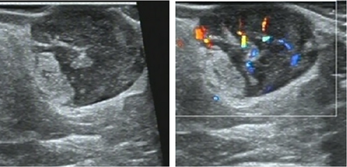 Details are in the caption following the image