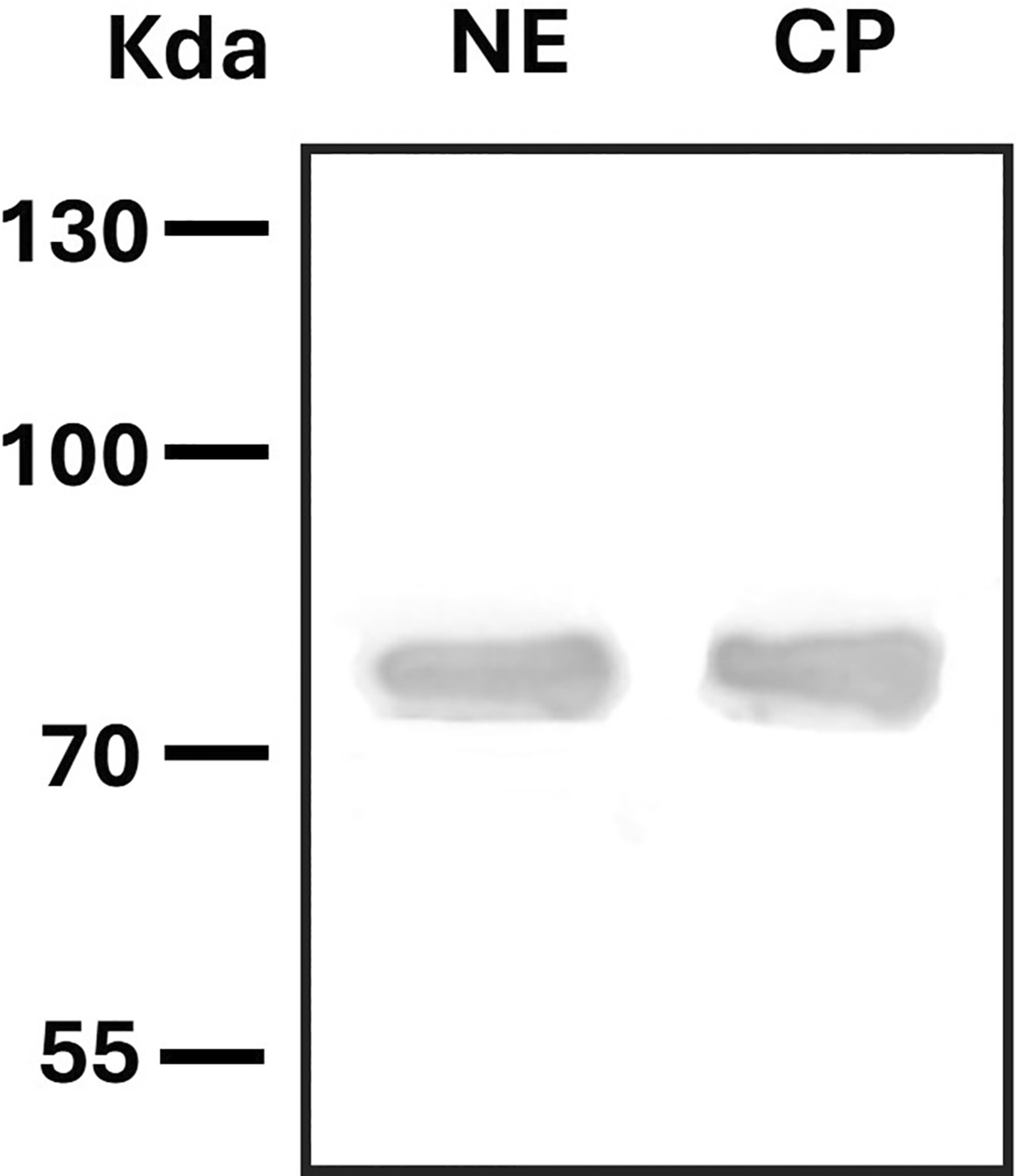 Characterising the expression of the organic cation transporter OCT3 in cutaneous papillomas of dogs