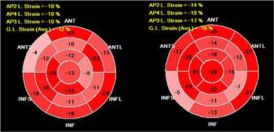 The impact of medical therapy on left ventricular strain: Current state and future perspectives