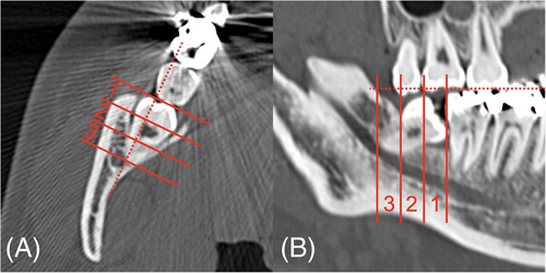Details are in the caption following the image