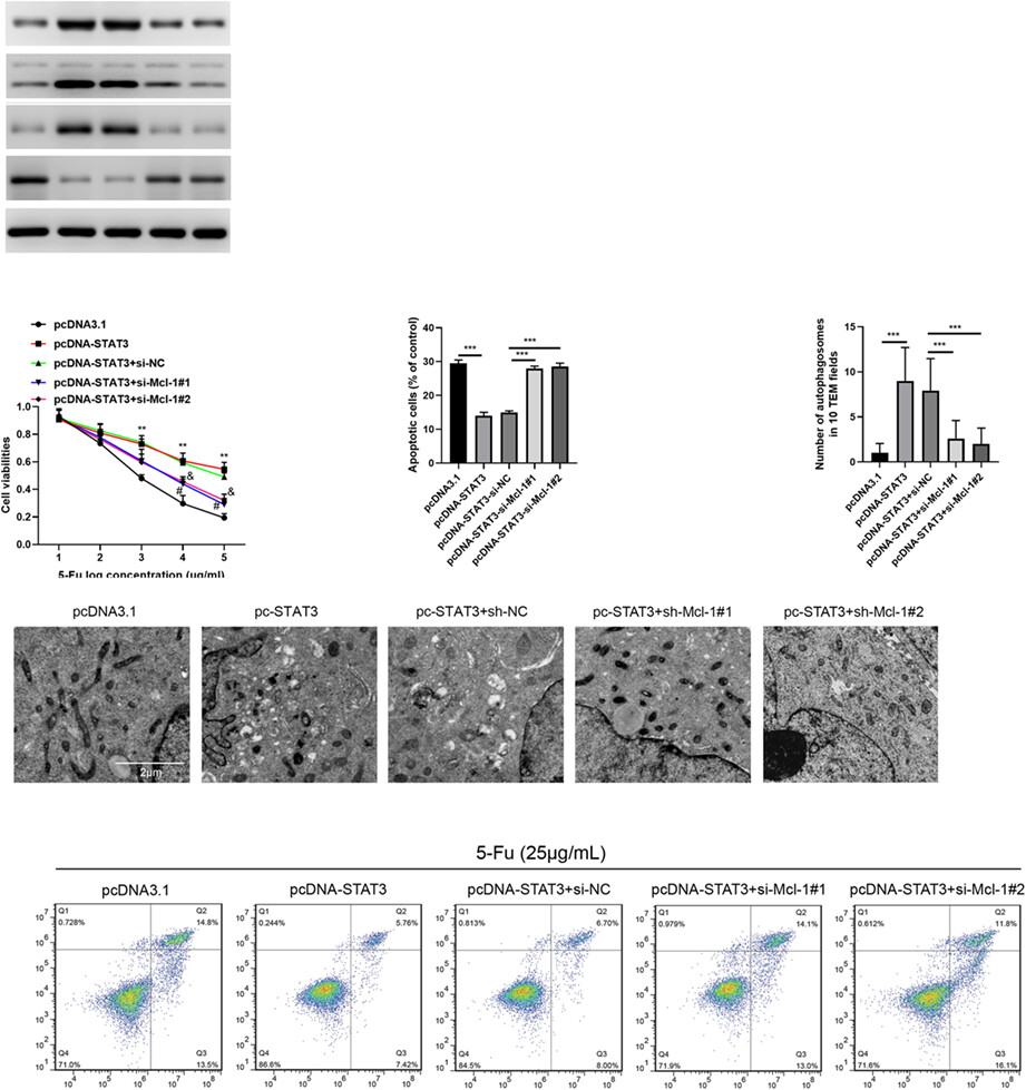 STAT3 regulates 5-Fu resistance in human colorectal cancer cells by promoting Mcl-1–dependent cytoprotective autophagy