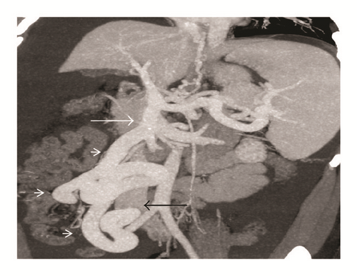 Details are in the caption following the image