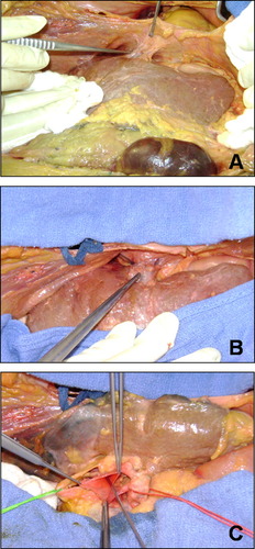 Details are in the caption following the image Details are in the caption following the image