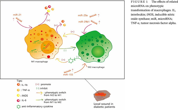 Effect and mechanism of microRNAs on various diabetic wound local cells microRNA对各种糖尿病创面局部细胞的作用及机制