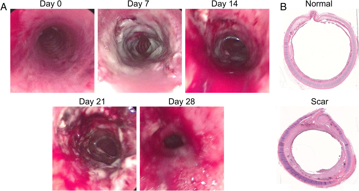 An Ovine Model Yields Histology and Gene Expression Changes Consistent with Laryngotracheal Stenosis