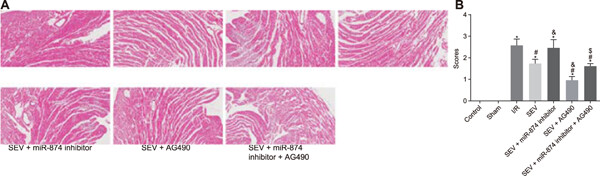 microRNA-874 inhibition targeting STAT3 protects the heart from ischemia–reperfusion injury by attenuating cardiomyocyte apoptosis in a mouse model