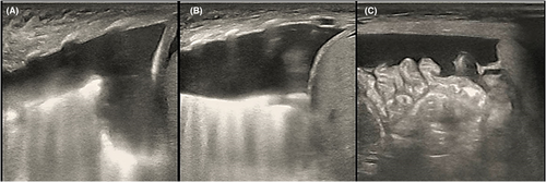 Details are in the caption following the image Details are in the caption following the image