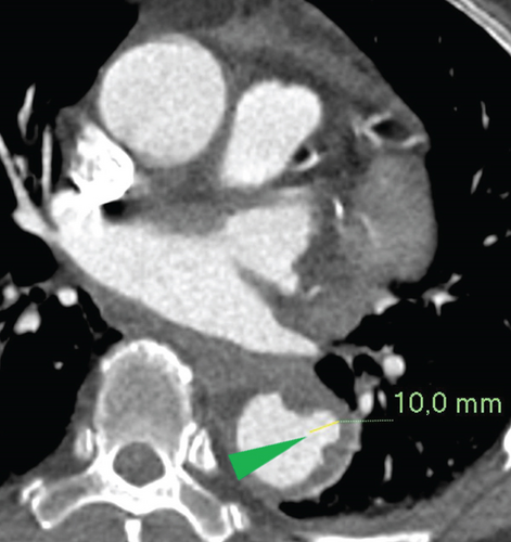Details are in the caption following the image Details are in the caption following the image