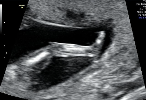Details are in the caption following the image