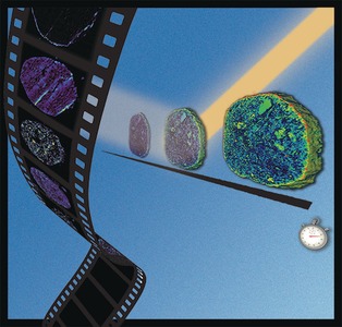 Visualizing Dealumination of a Single Zeolite Domain in a Real-Life Catalytic Cracking Particle