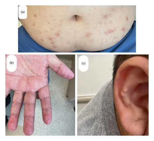 Details are in the caption following the image Details are in the caption following the image