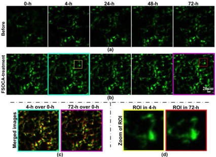 FSOCA-induced switchable footpad skin optical clearing window for blood flow and cell imaging in vivo