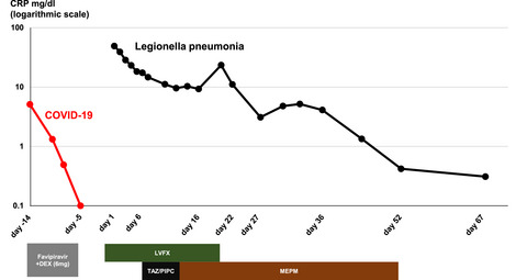 Legionella pneumonia immediately after recovery from COVID-19