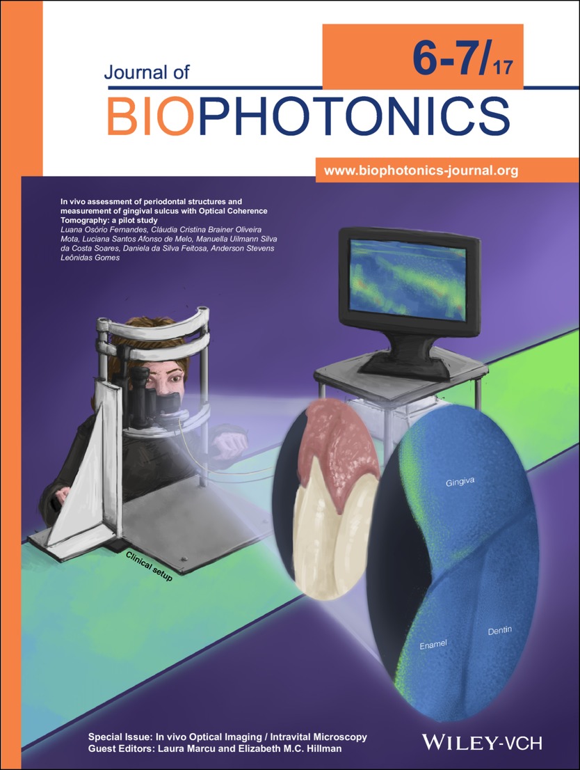 Inside Cover: In vivo assessment of periodontal structures and measurement of gingival sulcus with Optical Coherence Tomography: A pilot study (J. Biophotonics 6-7/2017) Volume 10 Issue 6-7, 2017