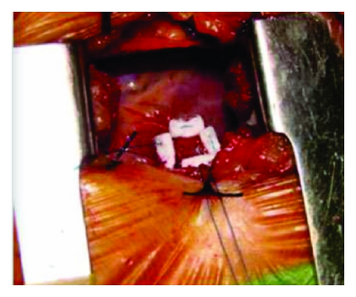 Details are in the caption following the image