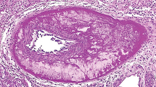 Details are in the caption following the image