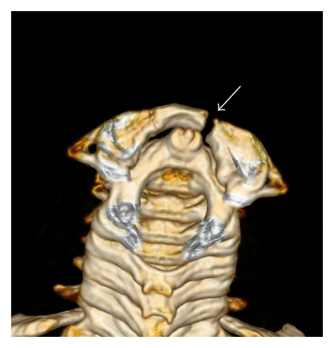 Details are in the caption following the image