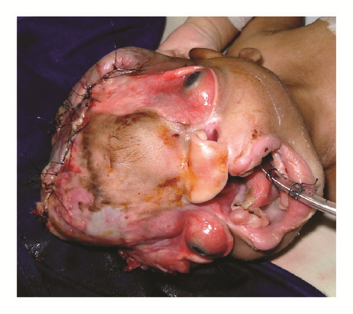 Details are in the caption following the image Details are in the caption following the image