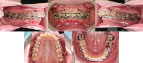 Details are in the caption following the image Details are in the caption following the image