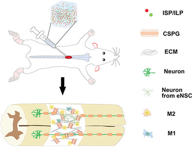 Remodeling Microenvironment for Endogenous Repair through Precise Modulation of Chondroitin Sulfate Proteoglycans Following Spinal Cord Injury