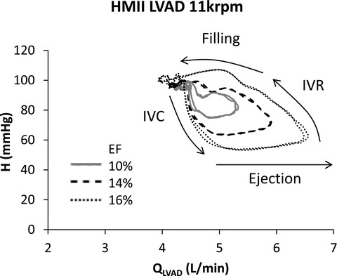 Dynamic pressure—flow curve analysis of the native heart and left ventricular assist device for full and partial bypass conditions