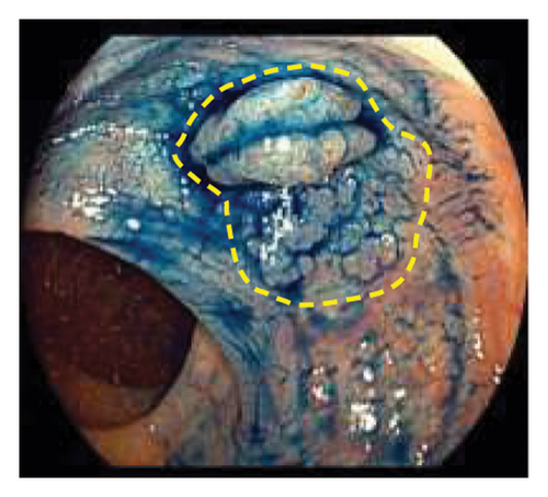 Details are in the caption following the image