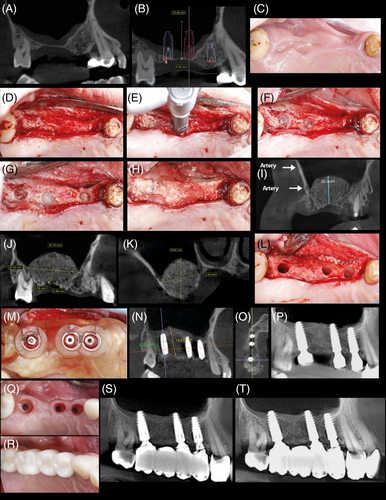 Details are in the caption following the image Details are in the caption following the image