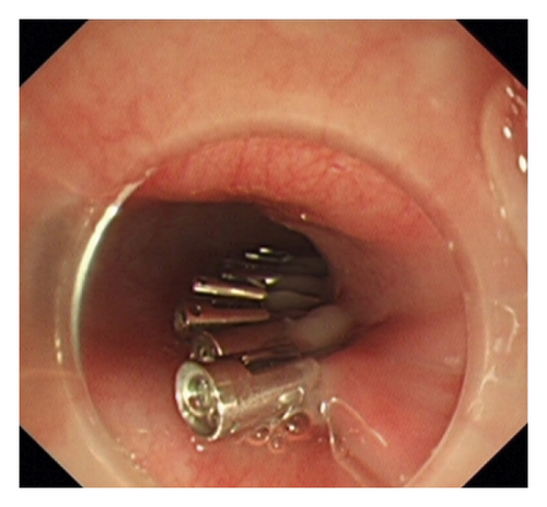 Details are in the caption following the image Details are in the caption following the image