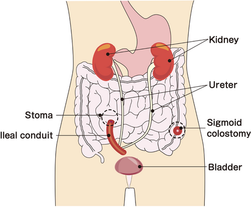 Details are in the caption following the image Details are in the caption following the image