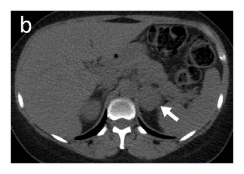 Details are in the caption following the image Details are in the caption following the image