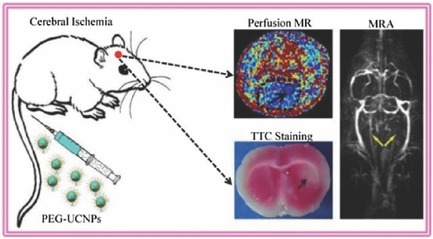 High-Performance Upconversion Nanoprobes for Multimodal MR Imaging of Acute Ischemic Stroke