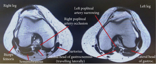 Details are in the caption following the image