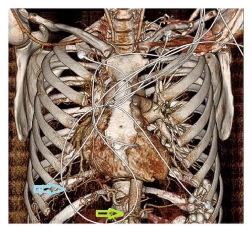 Details are in the caption following the image Details are in the caption following the image