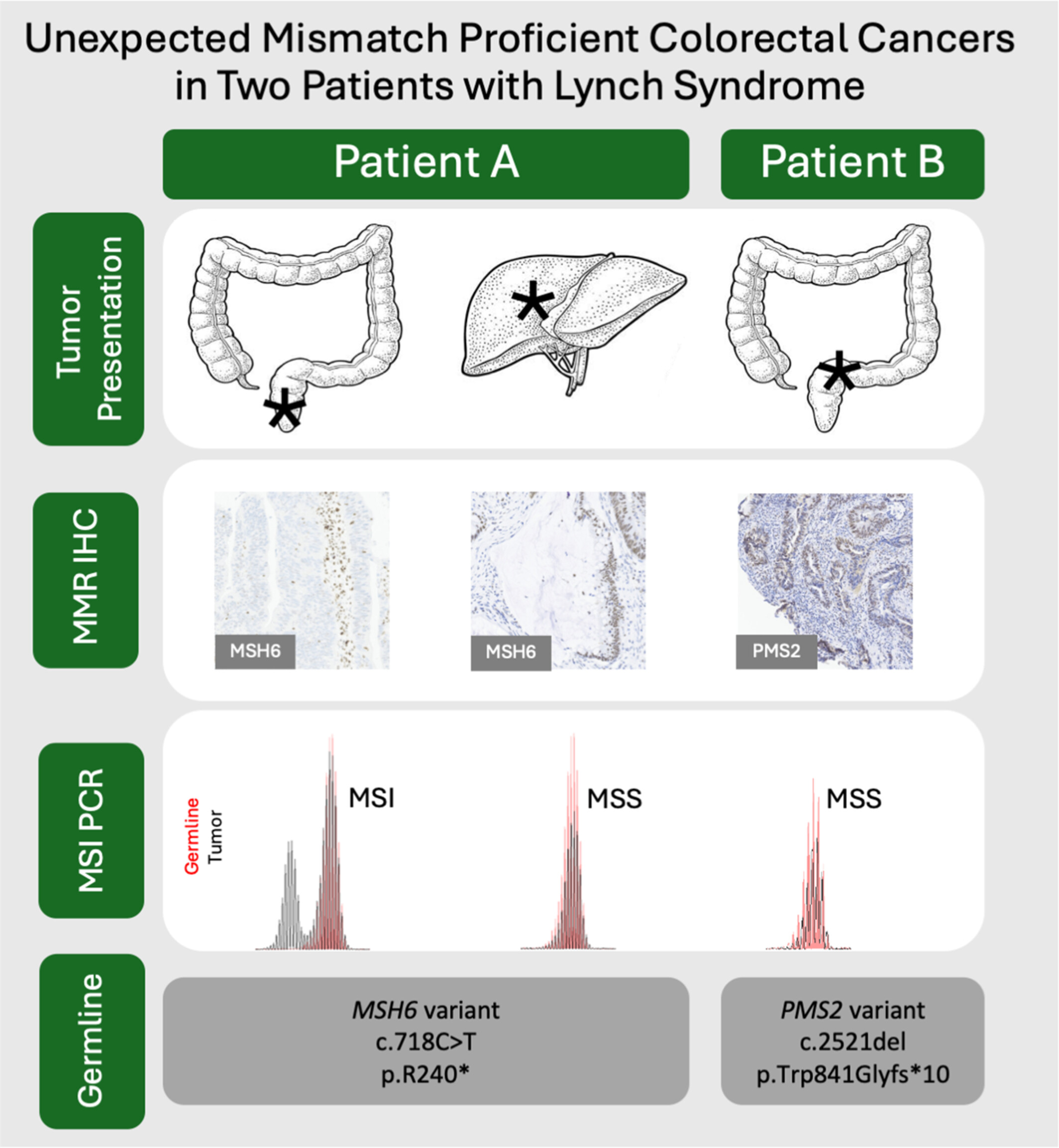 Mismatch Repair Proficient Colorectal Adenocarcinoma in Two Patients With Lynch Syndrome