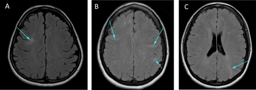 Details are in the caption following the image Details are in the caption following the image