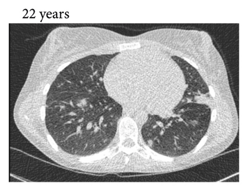 Details are in the caption following the image
