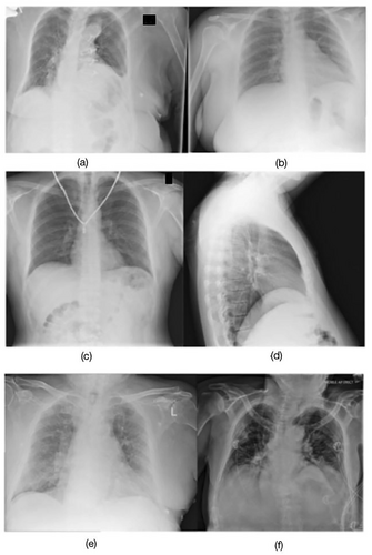 Details are in the caption following the image