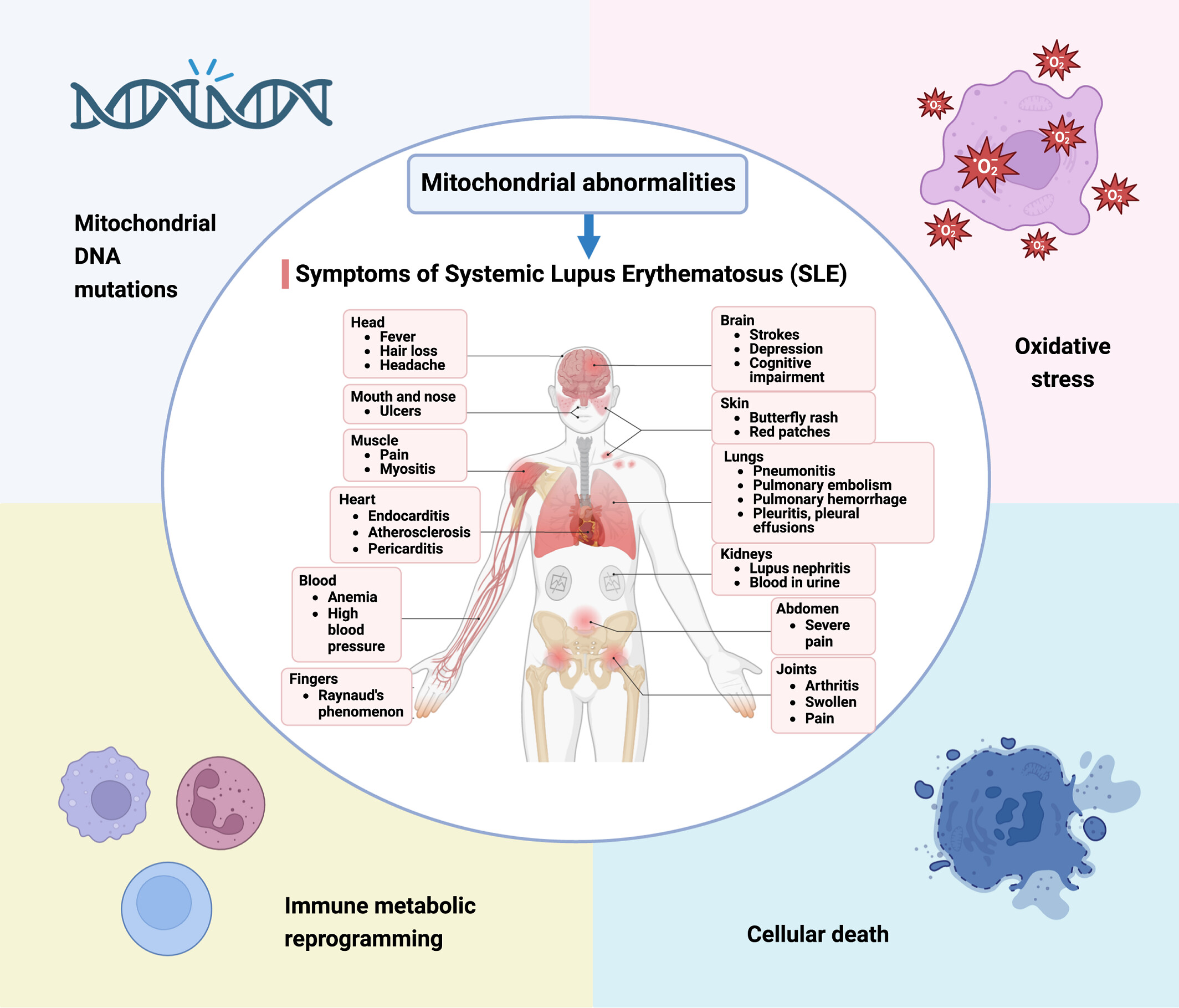 Mitochondrial aberrations in systemic lupus erythematosus pathogenesis: Insights and therapeutic implications