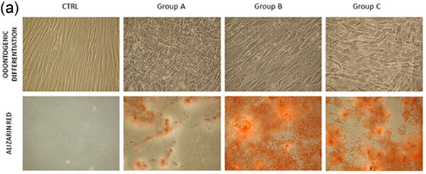 Dental pulp stem cells senescence and regenerative potential relationship