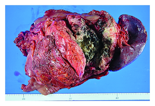 Details are in the caption following the image Details are in the caption following the image