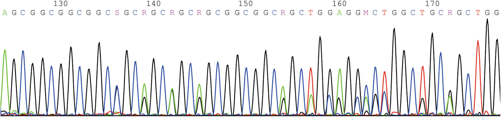 Congenital central hypoventilation syndrome in Chinese population: Analysis of three new cases and review of the literature