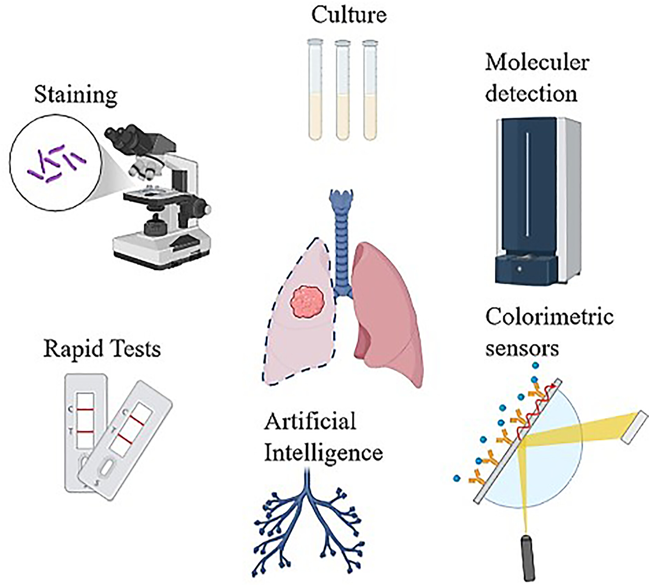The Recent Development in the Diagnosis of Mycobacterium tuberculosis