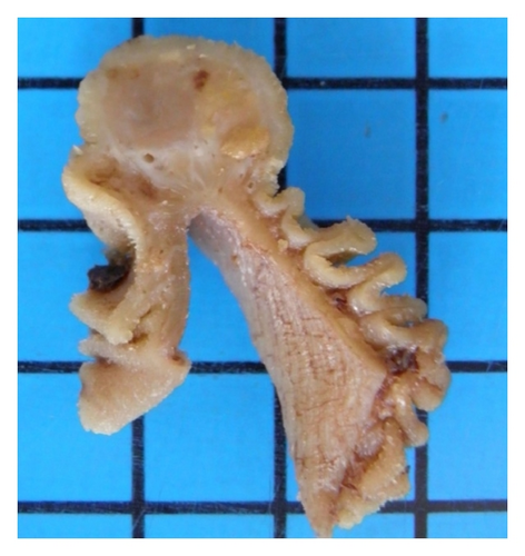 Details are in the caption following the image