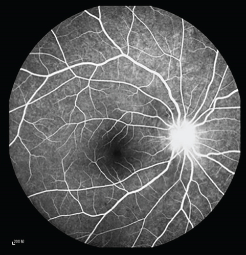 Details are in the caption following the image