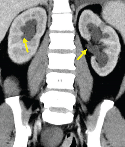 Details are in the caption following the image