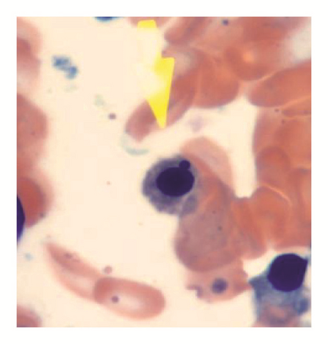 Details are in the caption following the image