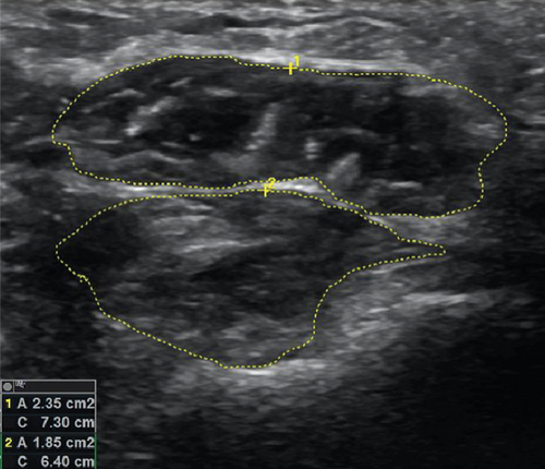 Details are in the caption following the image Details are in the caption following the image