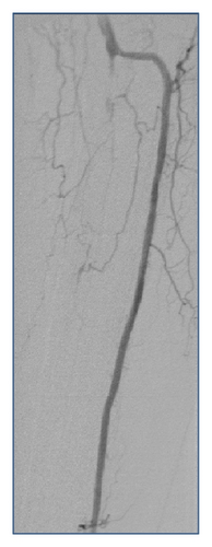 Details are in the caption following the image