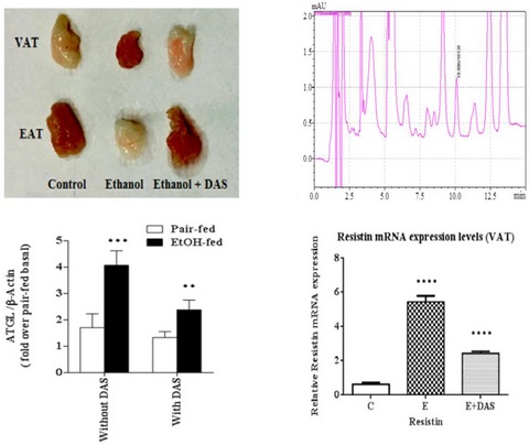 Protective Effects of Diallyl Sulfide Against Ethanol-Induced Injury in Rat Adipose Tissue and Primary Human Adipocytes